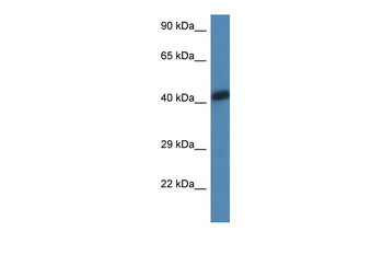 ACTA1 Rabbit Polyclonal Antibody