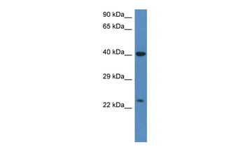 PRSS1 Rabbit Polyclonal Antibody