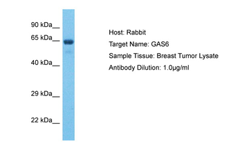 GAS6 Rabbit Polyclonal Antibody