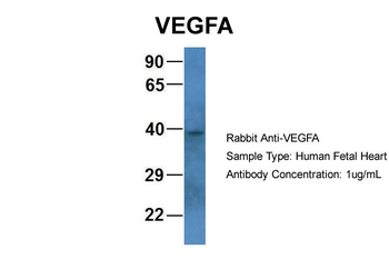 VEGFA Rabbit Polyclonal Antibody