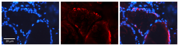 EGFR Rabbit Polyclonal Antibody