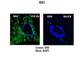 BID Rabbit Polyclonal Antibody