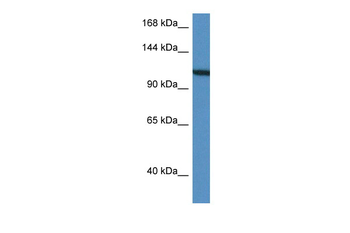 VCL Rabbit Polyclonal Antibody