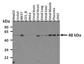 HEXA Rabbit Polyclonal Antibody