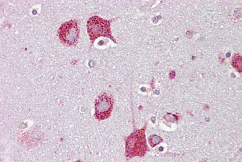 HEXA Rabbit Polyclonal Antibody