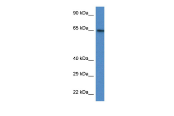 ACSS2 Rabbit Polyclonal Antibody