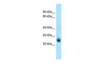 Rab5a Rabbit Polyclonal Antibody