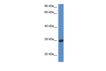 STX2 Rabbit Polyclonal Antibody