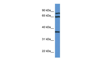 DHPS Rabbit Polyclonal Antibody