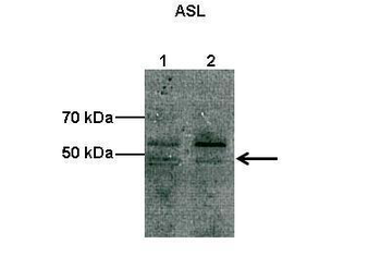 Asl Rabbit Polyclonal Antibody