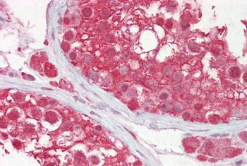CUL3 Rabbit Polyclonal Antibody
