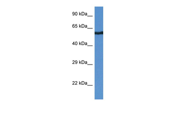 CAMK2B Rabbit Polyclonal Antibody