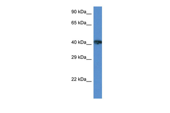 XRCC3 Rabbit Polyclonal Antibody