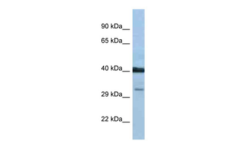PTGDR Rabbit Polyclonal Antibody