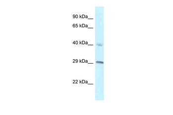 RCC1 Rabbit Polyclonal Antibody
