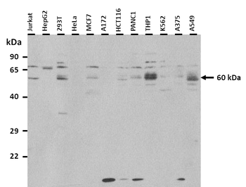 GBA Rabbit Polyclonal Antibody