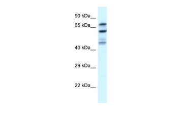 EIF2B5 Rabbit Polyclonal Antibody