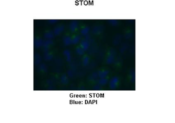 STOM Rabbit Polyclonal Antibody