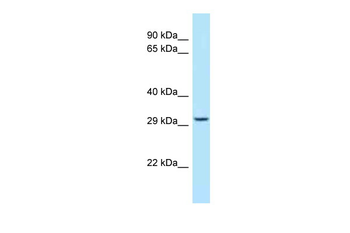 STOM Rabbit Polyclonal Antibody