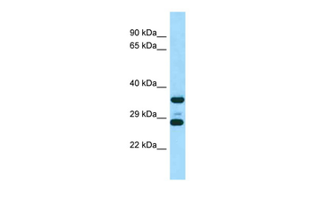 Rps6 Rabbit Polyclonal Antibody