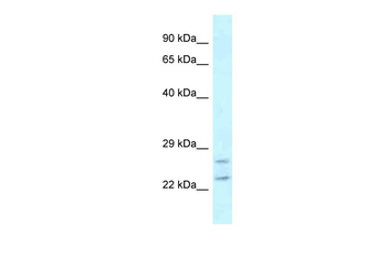 RAB2A Rabbit Polyclonal Antibody