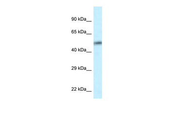 CAMK2D Rabbit Polyclonal Antibody