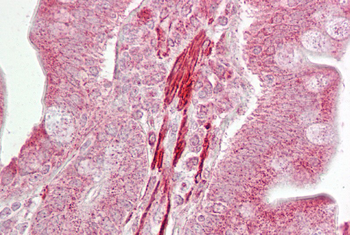 ROCK2 Rabbit Polyclonal Antibody