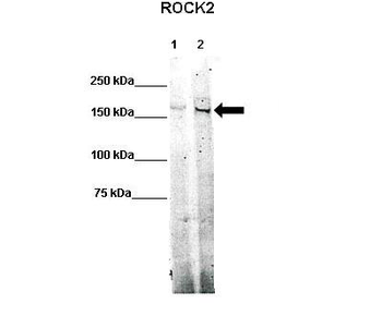 ROCK2 Rabbit Polyclonal Antibody
