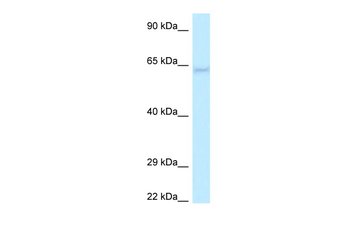 LGI1 Rabbit Polyclonal Antibody