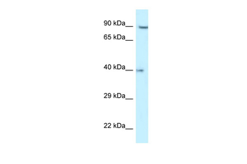 RFC2 Rabbit Polyclonal Antibody