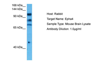 Epha4 Rabbit Polyclonal Antibody