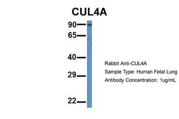 CUL4A Rabbit Polyclonal Antibody