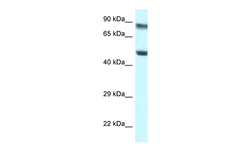 PUS1 Rabbit Polyclonal Antibody