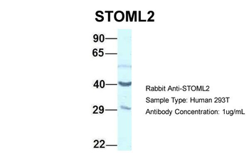STOML2 Rabbit Polyclonal Antibody