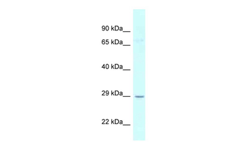 UCK1 Rabbit Polyclonal Antibody