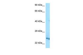 Cmpk1 Rabbit Polyclonal Antibody