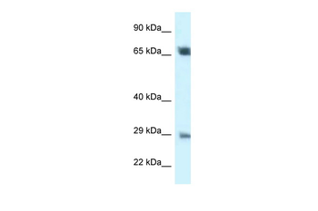 SPC25 Rabbit Polyclonal Antibody