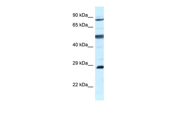 AK7 Rabbit Polyclonal Antibody