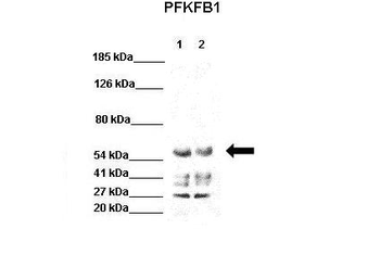 PFKFB1 Rabbit Polyclonal Antibody