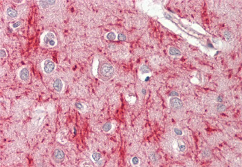MSRB3 Rabbit Polyclonal Antibody