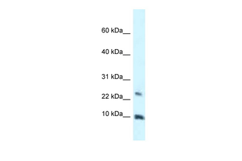 HMGN3 Rabbit Polyclonal Antibody