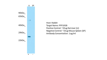 PPP1R3B Rabbit Polyclonal Antibody
