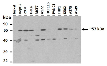 CDK5RAP3 Rabbit Polyclonal Antibody