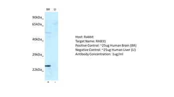 RAB31 Rabbit Polyclonal Antibody