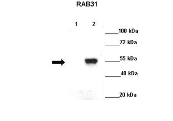 RAB31 Rabbit Polyclonal Antibody