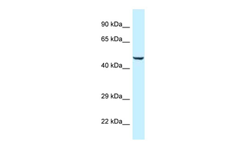 TRMO Rabbit Polyclonal Antibody
