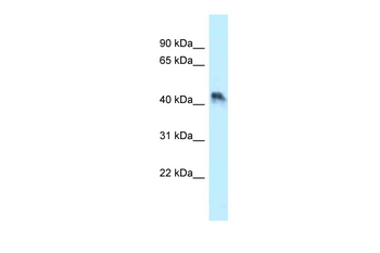 ENTPD5 Rabbit Polyclonal Antibody