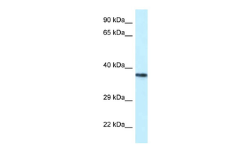 PSTPIP2 Rabbit Polyclonal Antibody