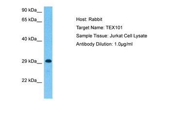 TEX101 Rabbit Polyclonal Antibody