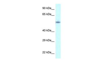 GORASP2 Rabbit Polyclonal Antibody